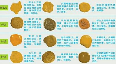 国内第三代助孕宝宝为什么拉绿屎